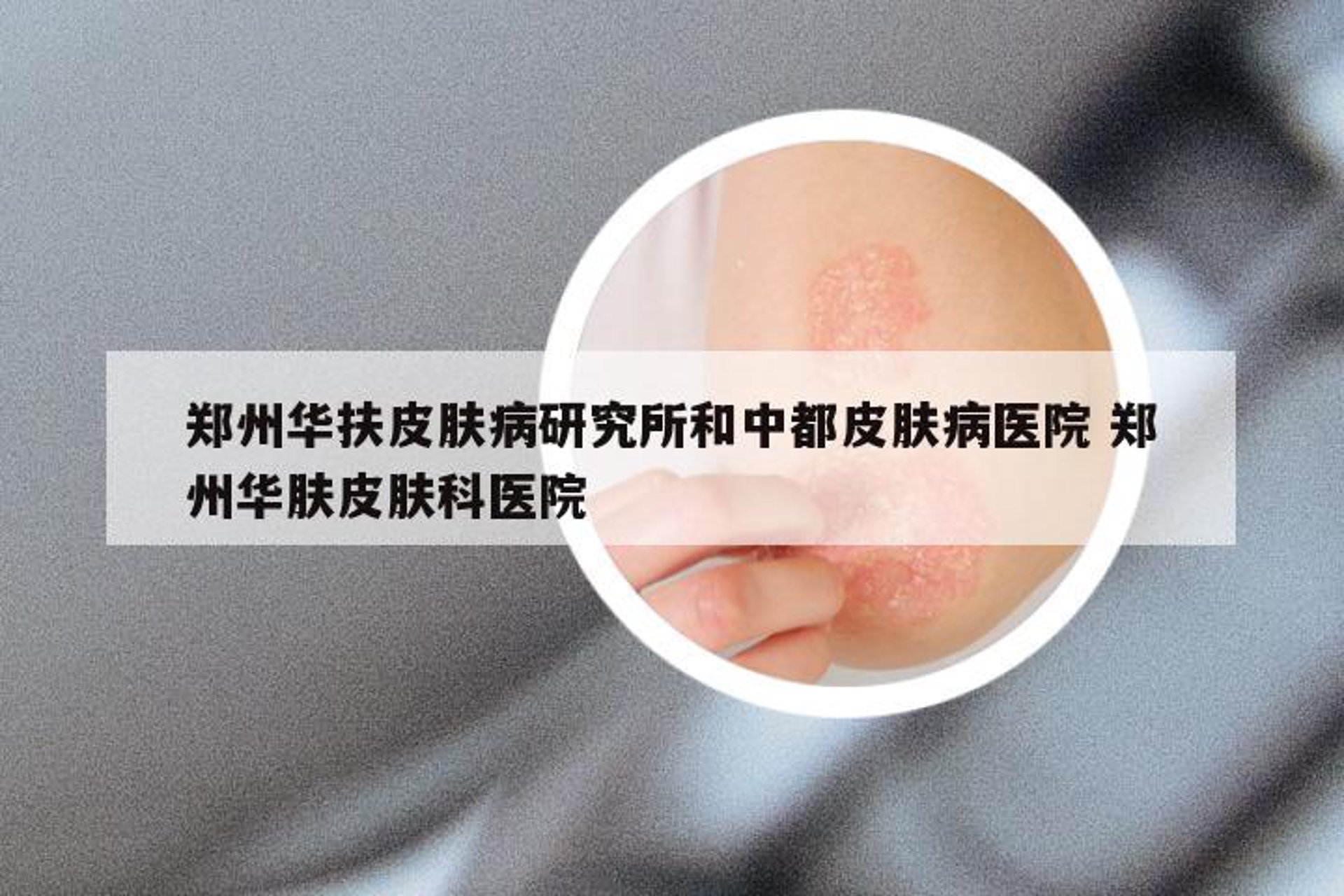 华肤皮肤病医院