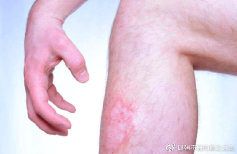 皮肤科医院：守护美丽的新篇章